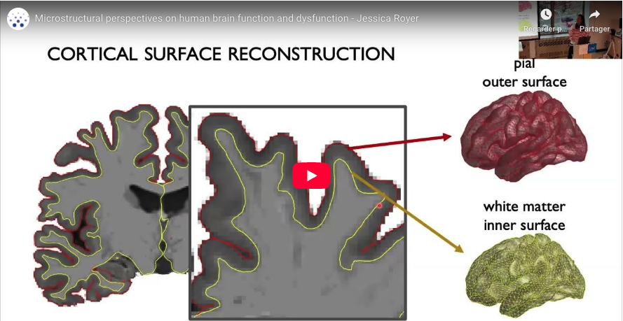 Read more about the article Microstructural perspectives on human brain function and dysfunction | Prof. Jessica Royer – McGill University