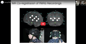 Read more about the article Using fNIRS to investigate how experience supports infant neural development | Prof. Lauren Emberson – University of British Columbia