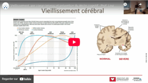 Read more about the article Tackling the Heart-Brain Axis: Aetiologies, Prevention and Lifestyle Interventions for Neurocognitive Deficits in Cardiovascular Diseases – Prof. Louis Bherer – Université de Montréal